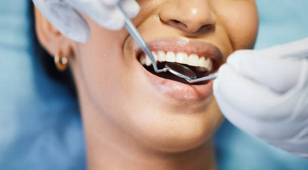Best Urgent Care for Lost Fillings or Crowns in Clinton, LA